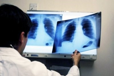 Сколько раз подряд можно делать рентген?
