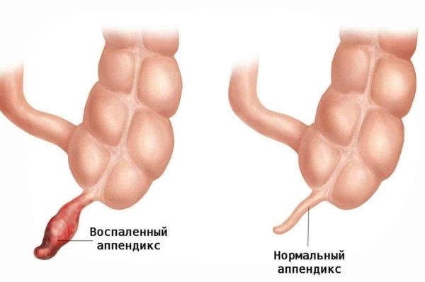 Когда используется после операции?