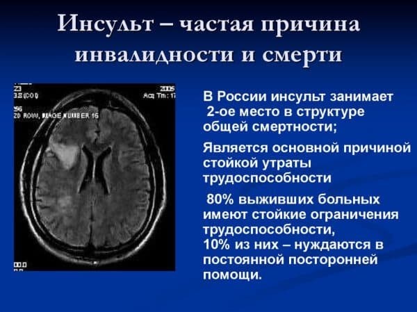 Сколько раз можно продлить листок нетрудоспособности